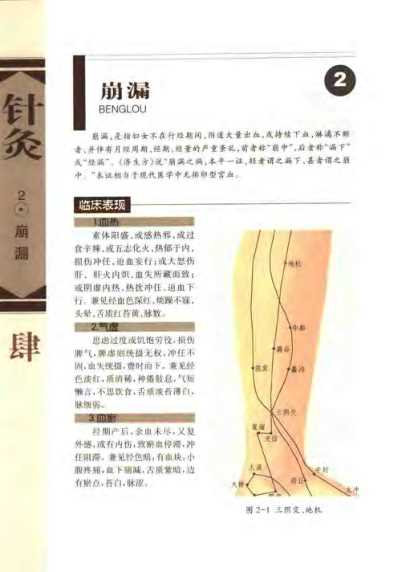 [下载][针灸治疗常见病证图解]妇-儿科分册_张建华.pdf