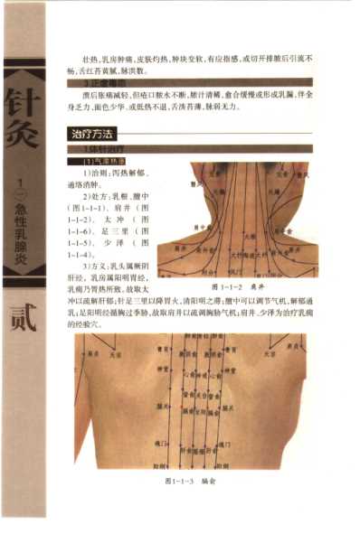 [下载][针灸治疗常见病证图解]外科-皮肤科分册.pdf