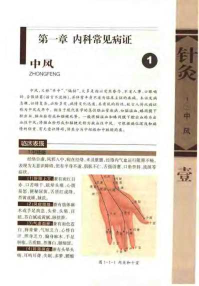 [下载][针灸治疗常见病证图解]内科分册_张建华.pdf