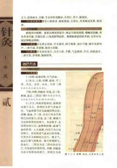 [下载][针灸治疗常见病证图解]内科分册_张建华.pdf