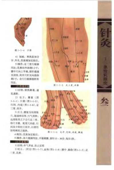 [下载][针灸治疗常见病证图解]外科-皮肤科分册_张建华.pdf